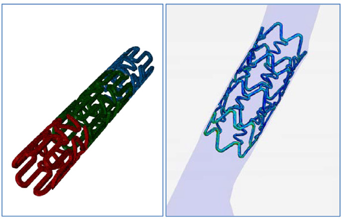 The superelastic alloy: How nitinol opened the doors for innovative medical  device design - Medical Device Network